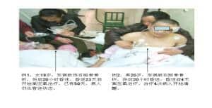 外科性迟发型昏迷